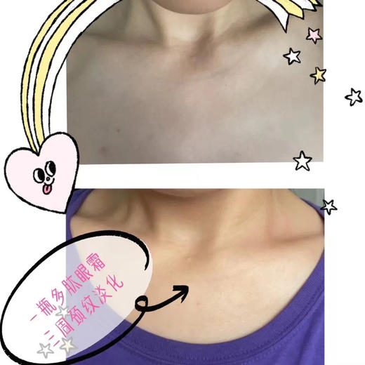 【十余年口碑 真抗皱】15克猪猪家多肽眼霜 均可兼职颈霜和面霜，多重多肽（类肉毒肽 六肽-8、三肽-1、三肽-5、四肽-7）膏体细腻清润 商品图3