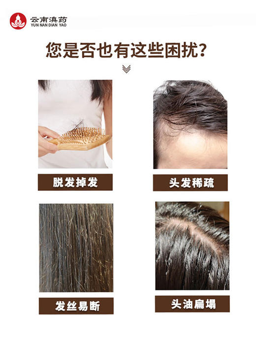 【湿重头油脱发】内调外养乌元康草本防脱洗发露+轻适康去湿茶大腹便便疲倦困重舌苔粘腻 商品图7