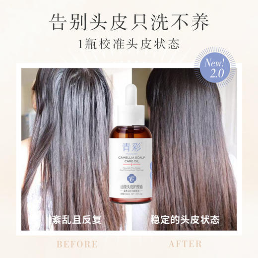 【1瓶/2瓶】青彩头皮护理油50ml A-3613 商品图3