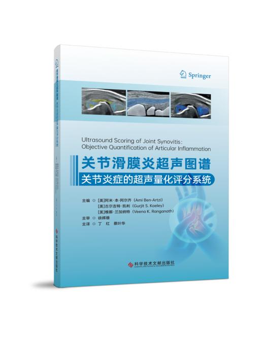 关节滑膜炎超声图谱：关节炎症的超声量化评分系统 李嘉主编 商品图0