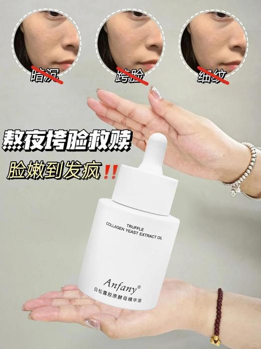 【Anfany伊芳妮--白松露胶原酵母精华油】🉐69得两瓶‼️💯 ✔️白松露菌提取物✔️双专利成分赤灵芝精粹/胶原 ✅“以油养肤”事半功倍⚠抗老 紧致肌肤 🫶淡纹 补水保湿💦 商品图3