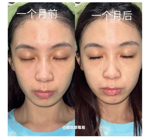 【11.17王炸割肉价】珀莱雅双白瓶精华36ml 商品图2