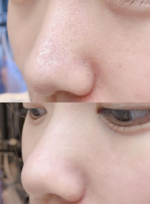 【11.17王炸割肉价】倩碧2号二次清洁水400ml 商品图4