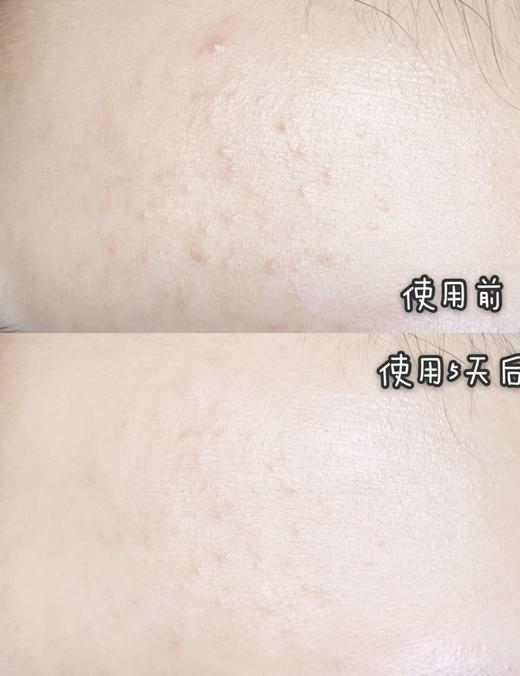 【11.17王炸割肉价】倩碧2号二次清洁水400ml 商品图5