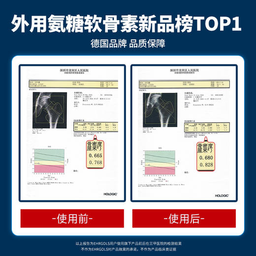 【德国进口，马拉松指定】EHRGOLS健耐德外用氨糖软膏，肩颈僵关节痛，一抹舒服 商品图3