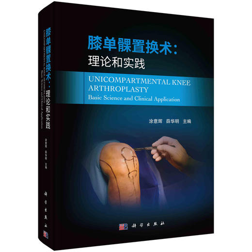 膝单髁置换术：理论和实践 商品图0