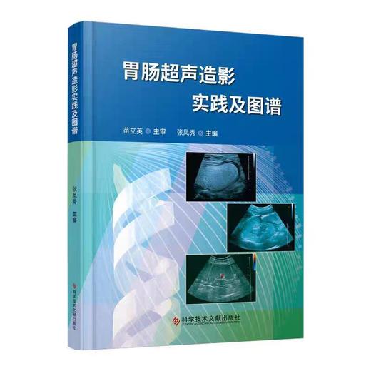 胃肠超声造影实践及图谱 商品图0