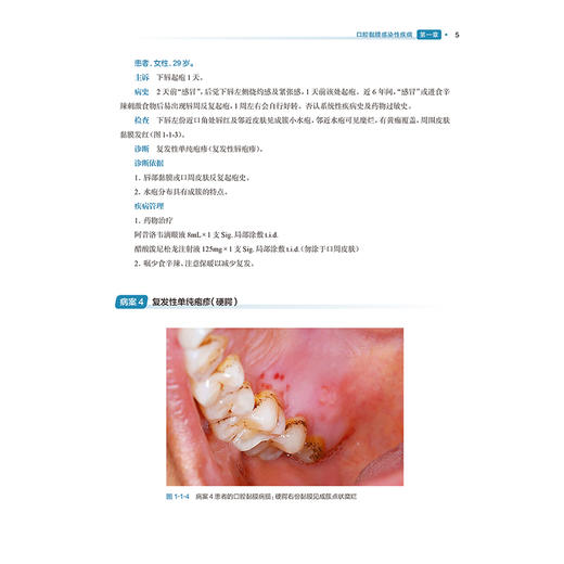 案析口腔黏膜病学 第3版 陈谦明 曾昕编 口腔粘膜临床案例口腔科学内科专科检查鉴别诊断口腔医师 人民卫生出版社9787117368889 商品图4