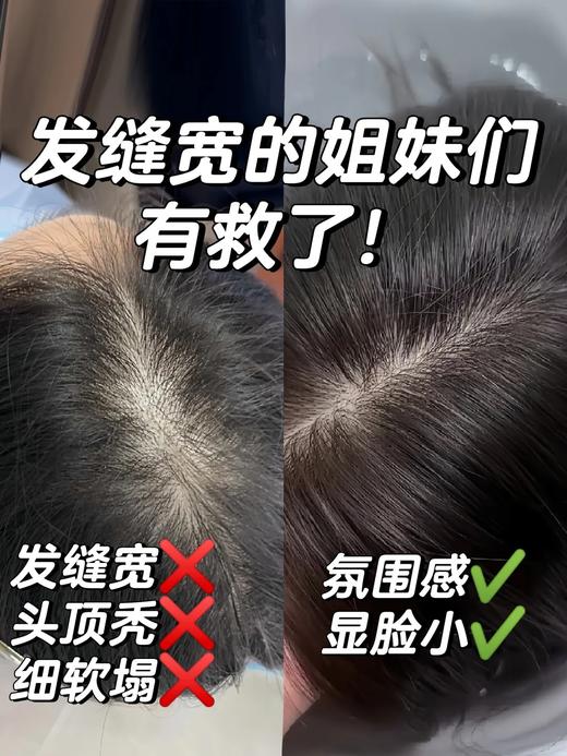 遮白补发🔥【全真发高颅顶假发片】 蓬松自然🔺 即时打造赵Lu思同款“头包脸”发型 😍 一秒化身氛围感美眉  自信up ❗️ 商品图2