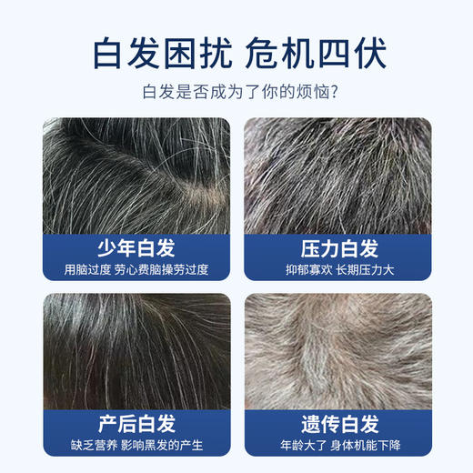 以黑养黑爆款！宜生堂乌根片  百年中医传承 古方乌根养发人参黑芝麻 养发以黑养黑药食滋补头发人参黑芝麻压片糖 少年白遗传白 中老年白发脱发断发 草本养发黑发片 60片/瓶 商品图1