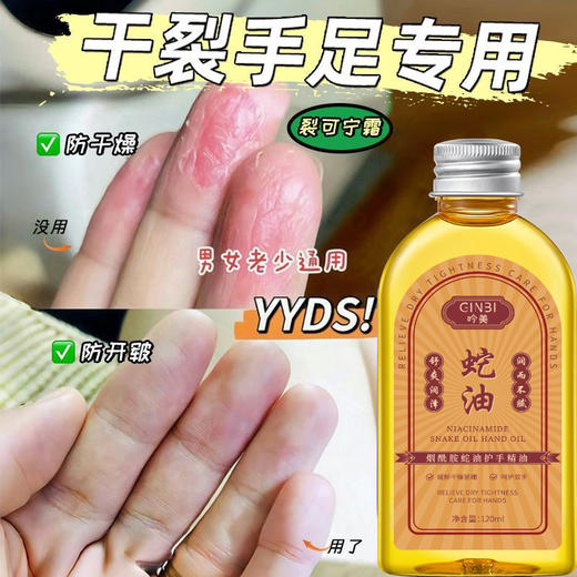 【福利❗️19.9抢3瓶，烟酰胺蛇油护手精油】吟美烟酰胺蛇油以油养肤，简单三步润透指尖，淡化双手细纹水润不紧绷，身体乳精华霜滋润保湿防干裂QQ 商品图0