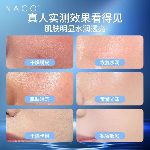 NACO高压注氧仪纳米喷雾补水仪家用补水器便携式手持水氧仪导入仪 商品图2