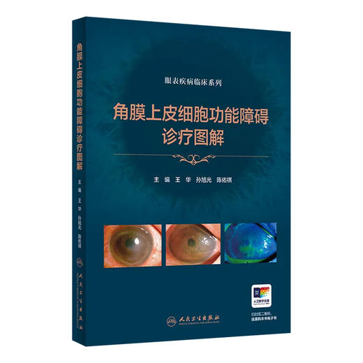 角膜上皮细胞功能障碍诊疗图解 眼表疾病临床系列 王华 孙旭光等编 先天性外伤性药源性临床眼科学诊断防治病例 人民卫生出版社 商品图1