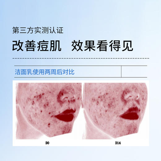 【姗拉娜】植优金典祛痘拉丝洁面乳 商品图3