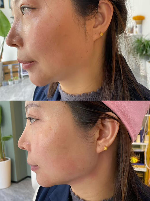 肤思特 年轻态新线雕精华【15%精华液和25%喷雾】瑞士芋螺毒素（精氨酸/赖氨酸）肽添加，即时提升法令纹 隐匿动态纹，紧致面部轮廓和松弛毛孔，对抗松弛下垂 商品图10