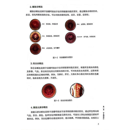 中华宇泉罐诊罐疗秘要 李玉泉 拔罐灌灸灌针注药作用机制操作方法 中医临床实践入门医学书籍内外妇儿骨科皮肤科 中国中医药出版社 商品图4