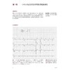 复杂心电图临床精解 2024年10月参考书 商品缩略图2