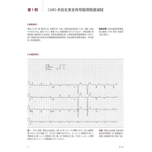 复杂心电图临床精解 2024年10月参考书 商品图2