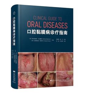 口腔黏膜病诊疗指南