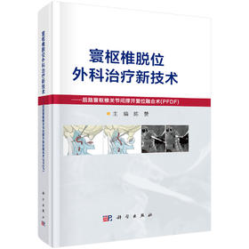 寰枢椎脱位外科治疗新技术——后路寰枢椎关节间撑开复位融合术（PFDF）