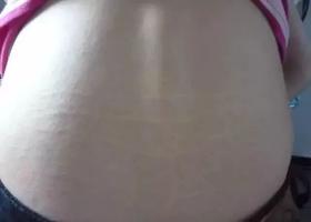  长了肾虚纹就是肾虚？不一定，这些症状满足了3个，肾才是真的虚 