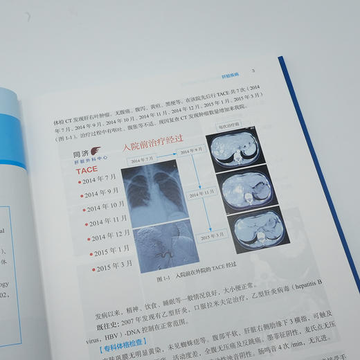 肝胆胰疾病多学科诊疗病例精选 商品图4