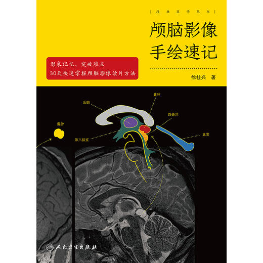 颅脑影像手绘速记 商品图1