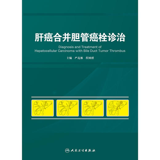 肝癌合并胆管癌栓诊治 2024年11月参考书 商品图1