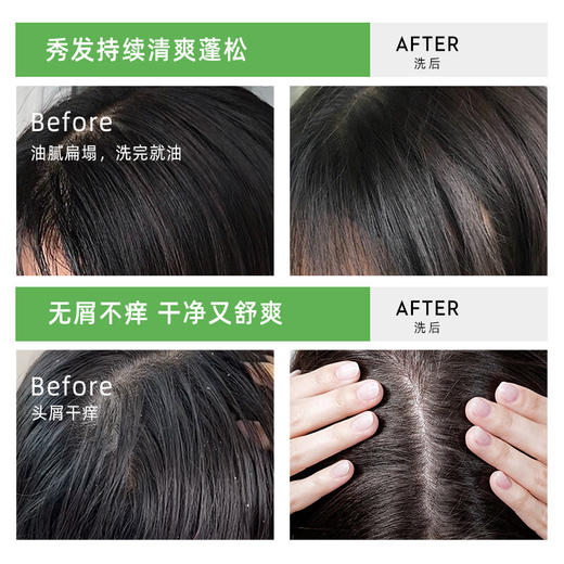 酮康采乐  去屑洗发露（控油去屑）420ml*2   CL15 商品图3