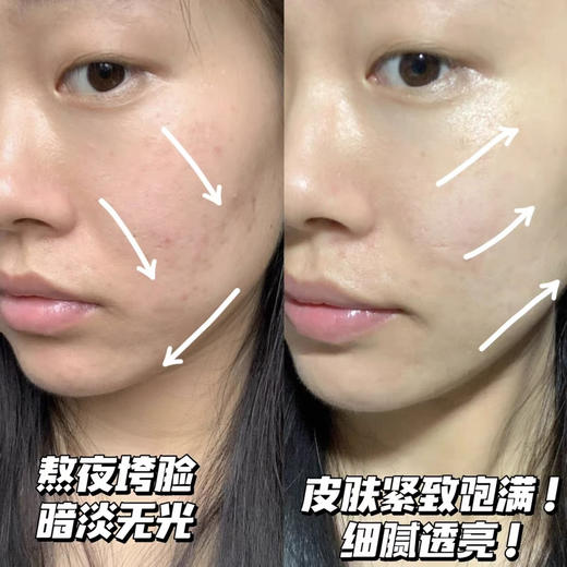 【海关监管】第四代OLAY玉兰油大红瓶信号肽面霜-抗皱紧致抗抗衰老-会员5折 商品图3