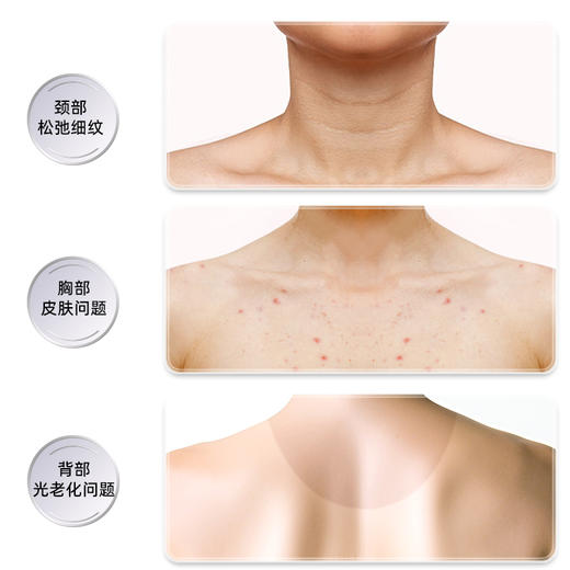 轻松重获天鹅颈 | Miniface天鹅颈光子嫩肤仪 商品图2