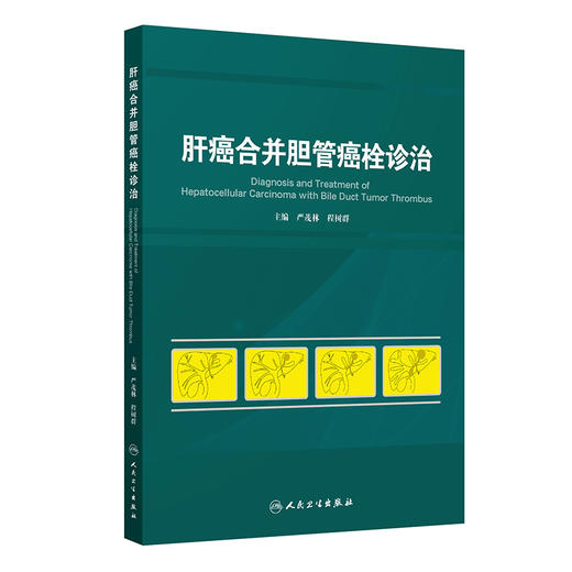 肝癌合并胆管癌栓诊治 2024年11月参考书 商品图0