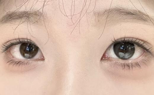 Chonos品牌日抛-月影水光（10片/盒） 商品图2