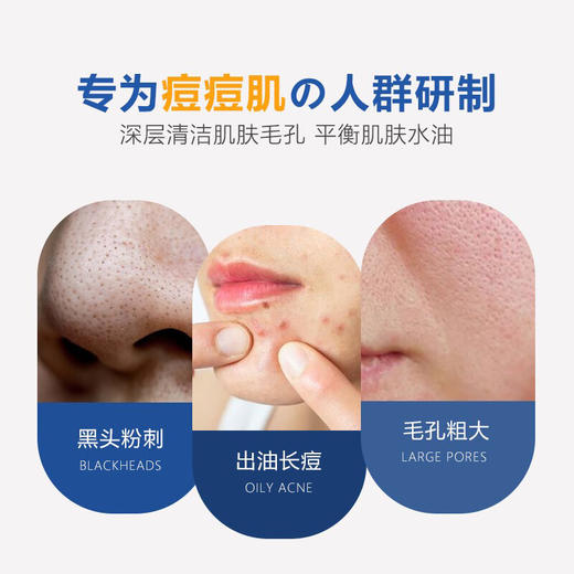 柳屋 祛痘洁面乳 140g 商品图2