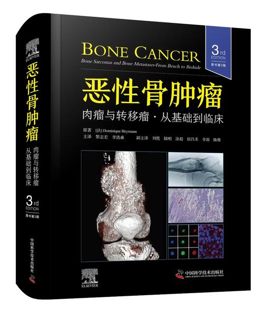 恶性骨肿瘤 肉瘤与转移瘤从基础到临床 主译  黎志宏  李浩淼  辽科出版 商品图0