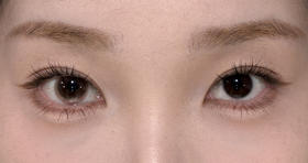 Chonos日抛美瞳 恋爱脑袋 14.2mm