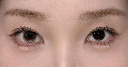 Chonos日抛美瞳 恋爱脑袋 14.2mm 商品图0