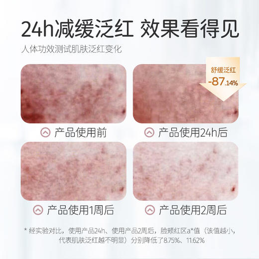 松达 婴儿山茶油特护霜 98g 商品图2