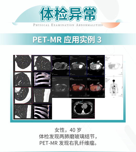 PET/MR精准检测 商品图2