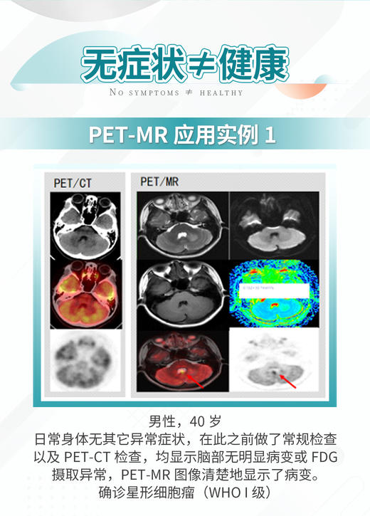 PET/MR精准检测 商品图1