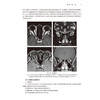 头颈部分册 临床磁共振成像系列丛书 鲜军舫 张辉 刘兆会主编 眼及眼眶疾病的影像学诊断价值比较 9787117370424人民卫生出版社 商品缩略图4