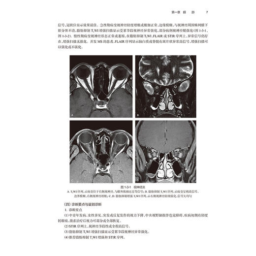 头颈部分册 临床磁共振成像系列丛书 鲜军舫 张辉 刘兆会主编 眼及眼眶疾病的影像学诊断价值比较 9787117370424人民卫生出版社 商品图4
