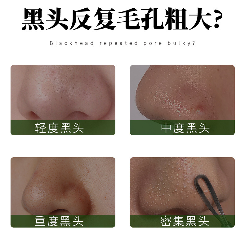 AOPY寡肽去黑头精华套盒_03