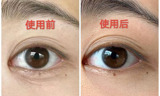 EISA RUI肌肽磁石御龄眼膜 商品图9