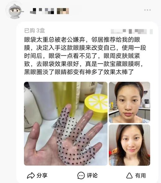 EISA RUI肌肽磁石御龄眼膜 商品图6