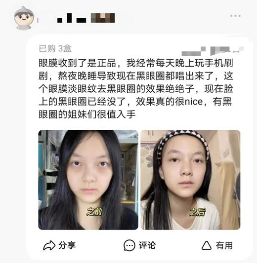 EISA RUI肌肽磁石御龄眼膜 商品图4