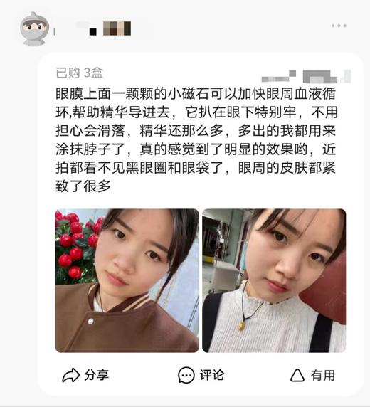 EISA RUI肌肽磁石御龄眼膜 商品图5