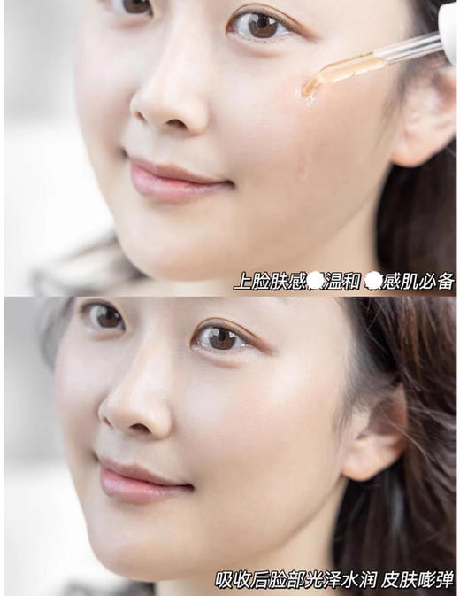 【3.29王炸割肉价】美版Obagi欧邦琪10%原型VC精华液30ml C10（限2025年3月-4月 随机发） 商品图5