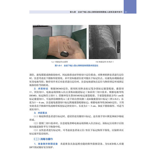 全皮下植入型心律转复除颤器临床应用培训教程 心脏起搏 心血管内科 陈样新 牛红霞 李耀东 中华医学电子音像出版社9787830054090 商品图2