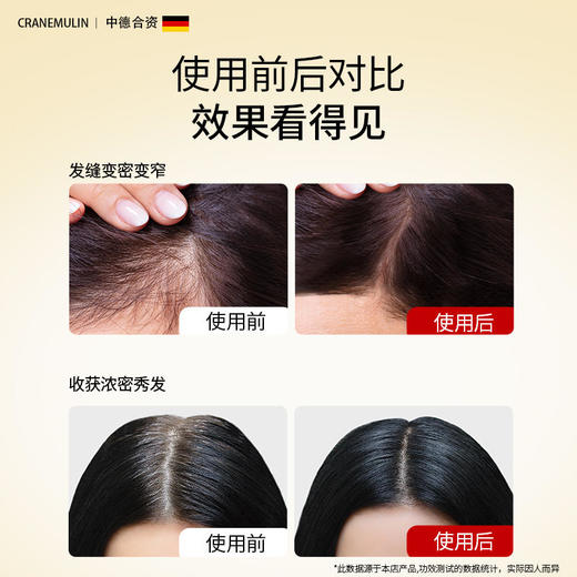 【买一送一】全新升级第三代克兰慕林防脱发洗发水侧柏叶咖啡因防脱固发植物成分去油净头皮水油平衡清洁油脂260ml/瓶 商品图2